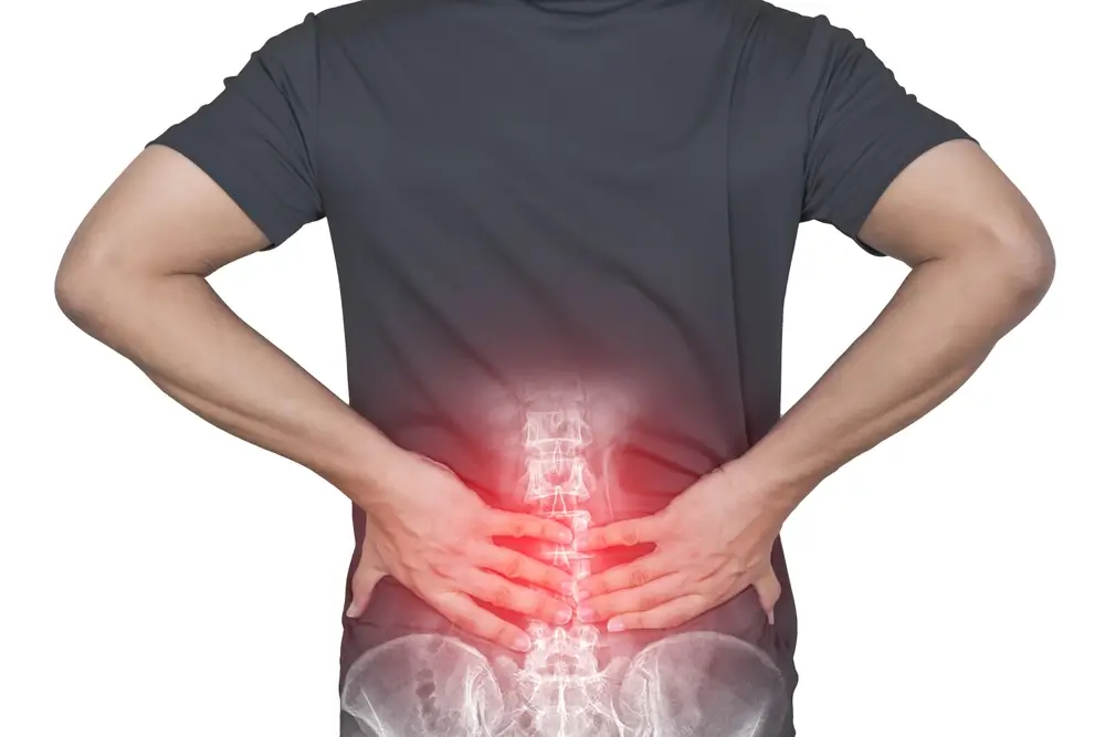 276e6c08ec Physio for back Pain